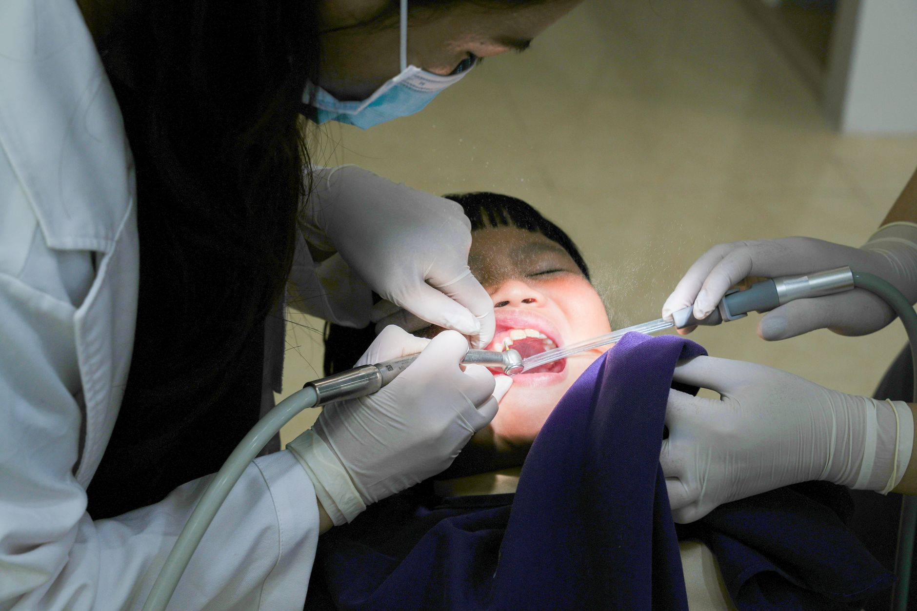 A young child receiving dental treatment from a masked dentist using dental tools indoors. — Squence Of Events and Dental Dis